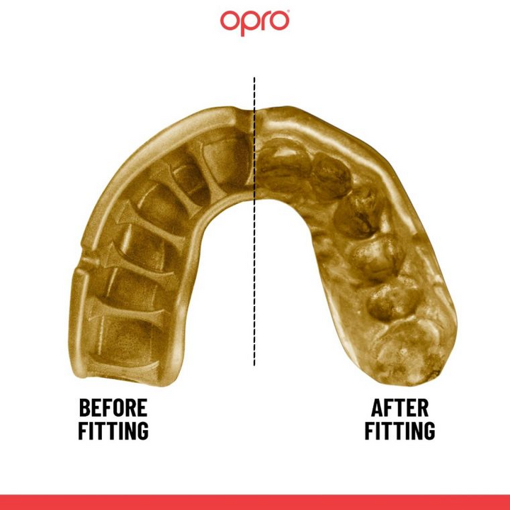 Opro Self-Fit Gold Mouthguard